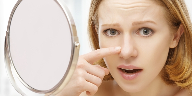 woman who has adult acne